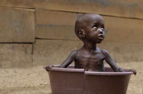 Article : Région du Kasaï en RDC, après la guerre, les enfants meurent de malnutrition  